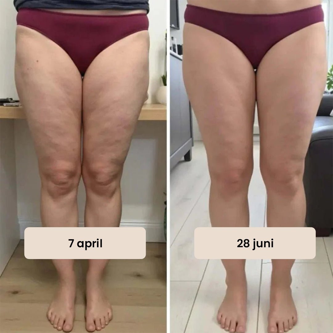 Sømløse anti-cellulite-leggings - Gymfit
